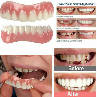 2x Top + Bottom Veneers False Teeth  Smile Cosmetic Denture Dental .